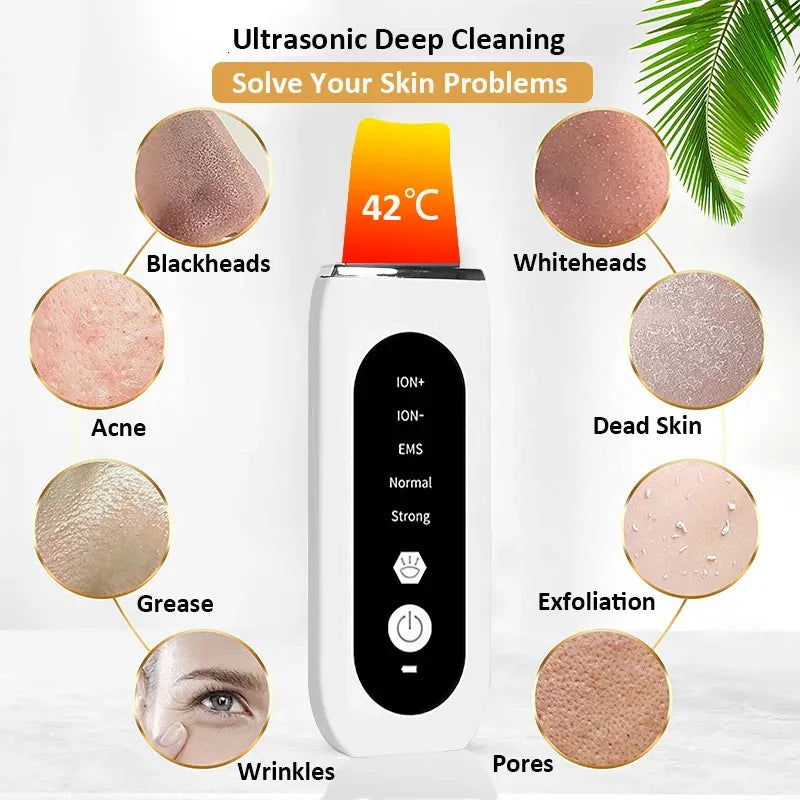 Shovel Skin Blackhead Ultrasonic Beauty Microcurrent Color Light