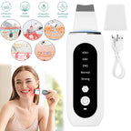 Shovel Skin Blackhead Ultrasonic Beauty Microcurrent Color Light